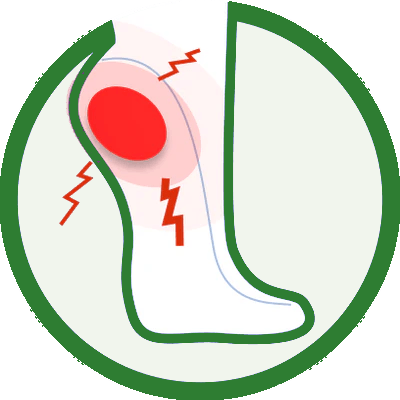 Plantar Fasciitis
